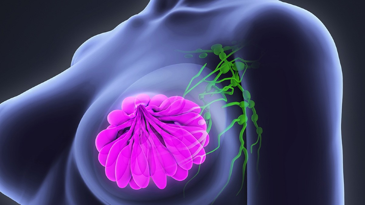 Este es el origen del listón rosa; insignia para la prevención del cáncer de mama