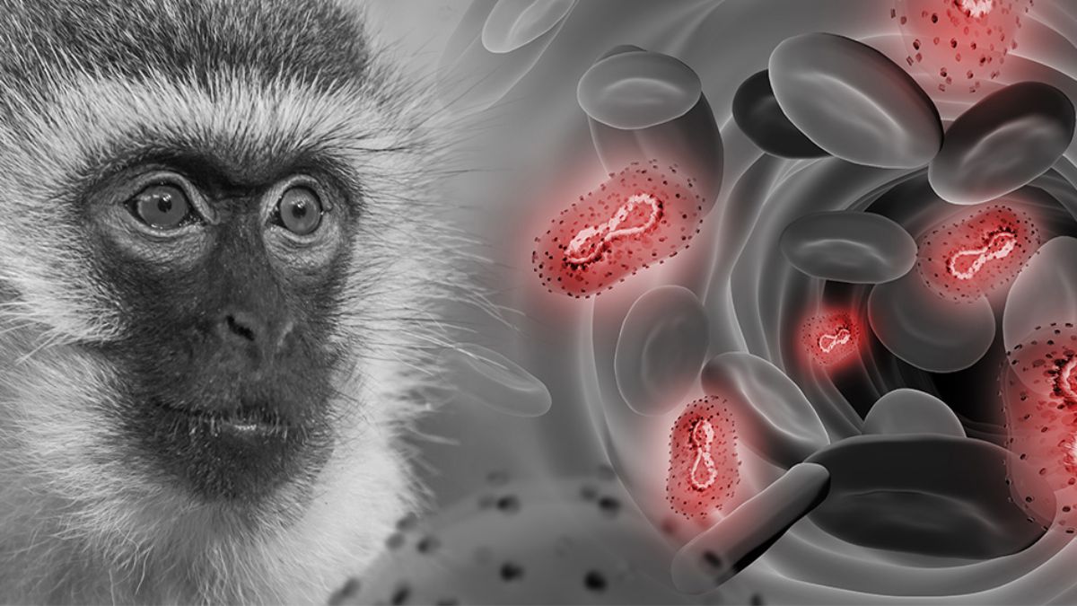 Acumula México casi 3 mil 500 casos de viruela del mono