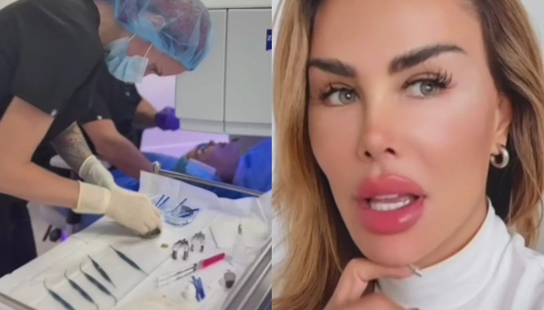 Ninel Conde revela cambio radical de ojos ¡increíble! 2 Ninel Conde y sus nuevos ojos