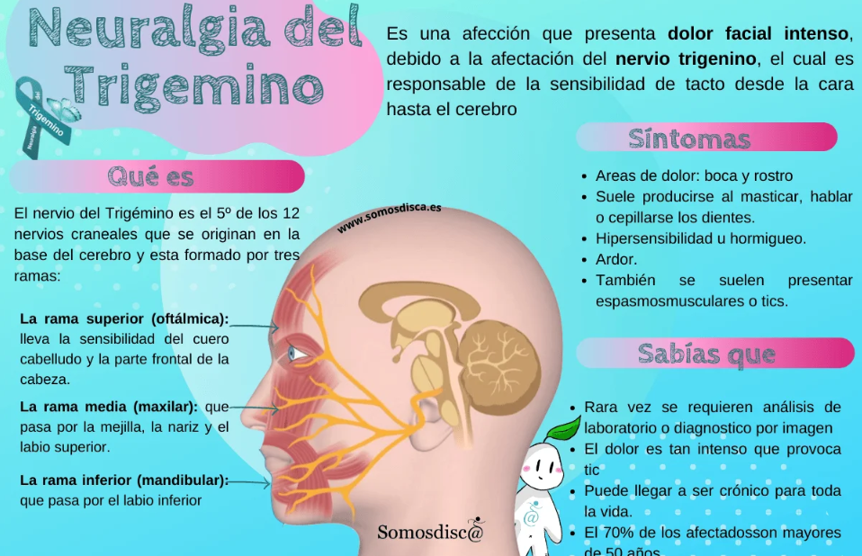 neuralgia del trigémino
